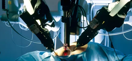 Robotic surgery in gynecology - myomectomy and hysterectomy by Dr. Prithivi Perum, Manikonda, Hyderabad