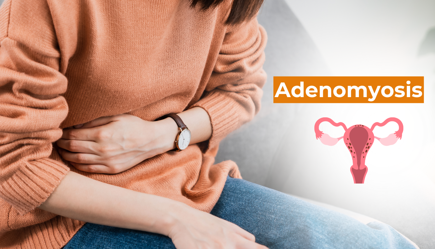 Adenomyosis