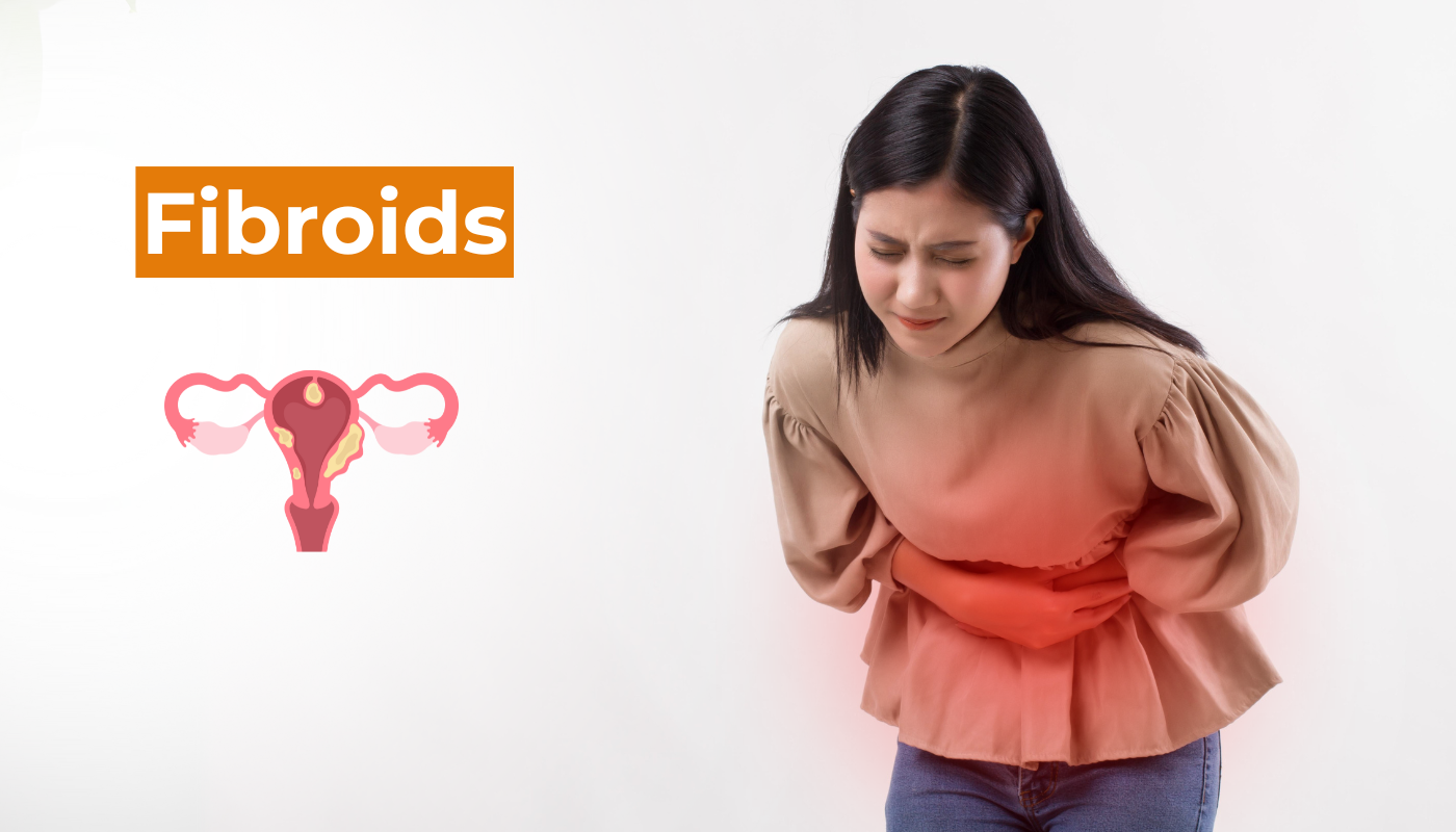 Fibroids