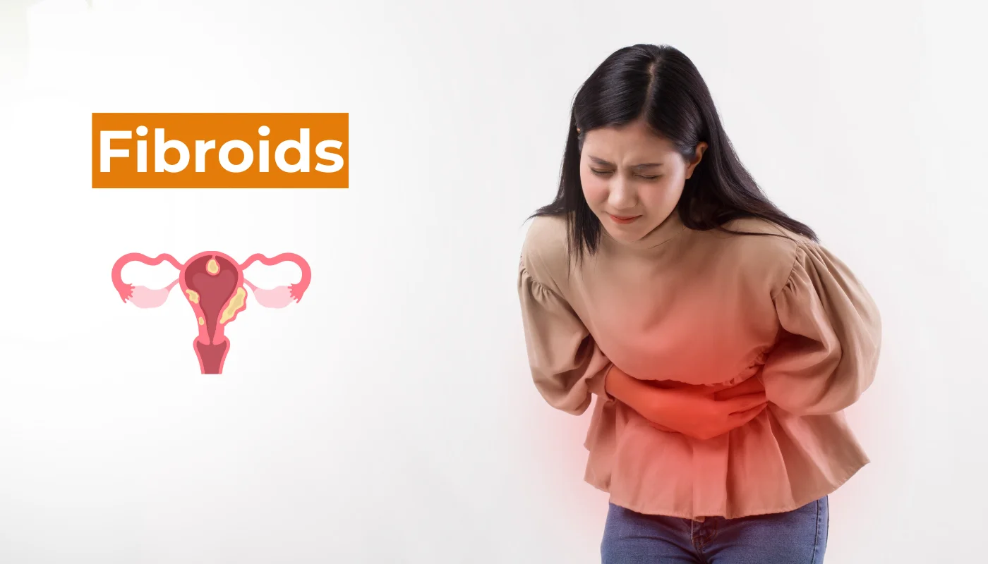 Uterine fibroids diagnosis and treatment by Dr. Prithivi Perum, Manikonda, Hyderabad