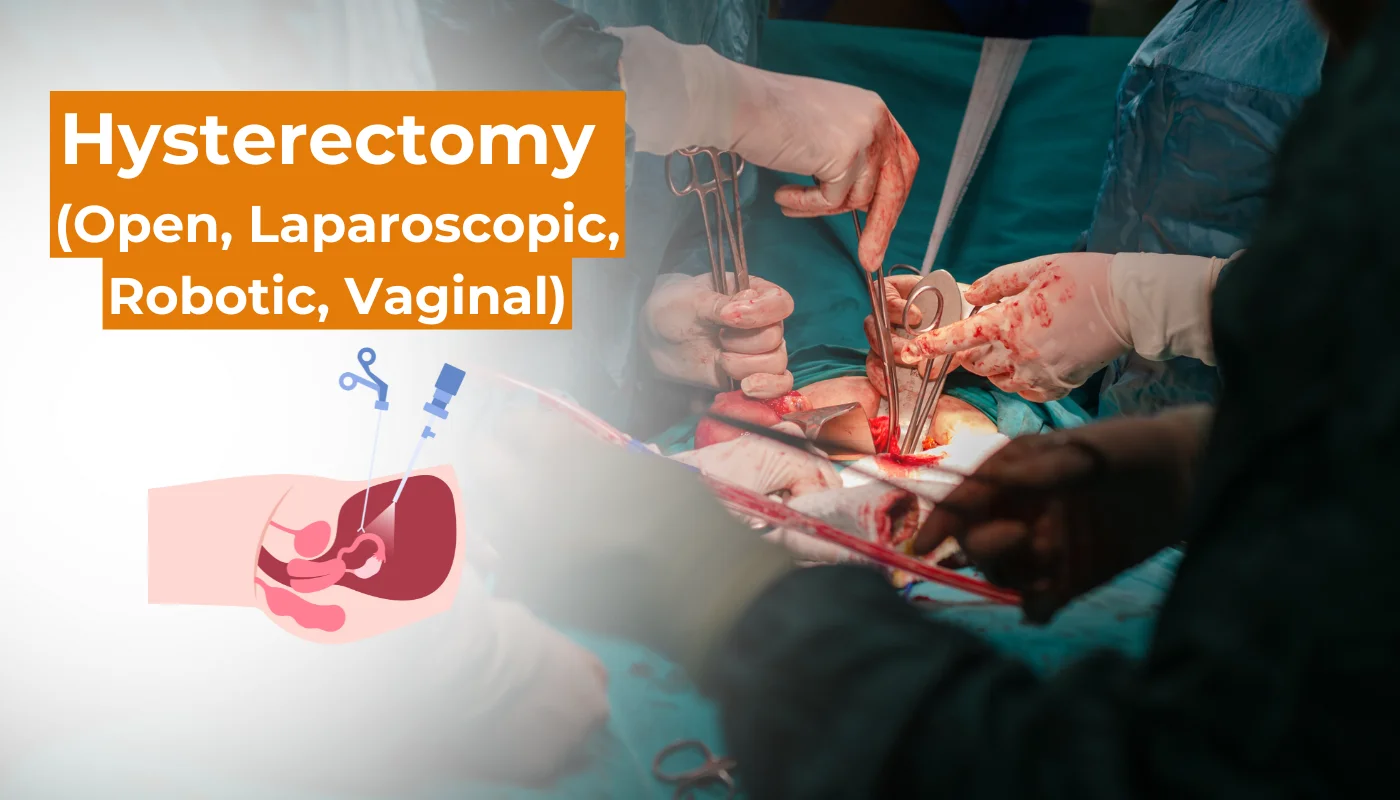 Minimally invasive hysterectomy and gynecologic surgery in Hyderabad